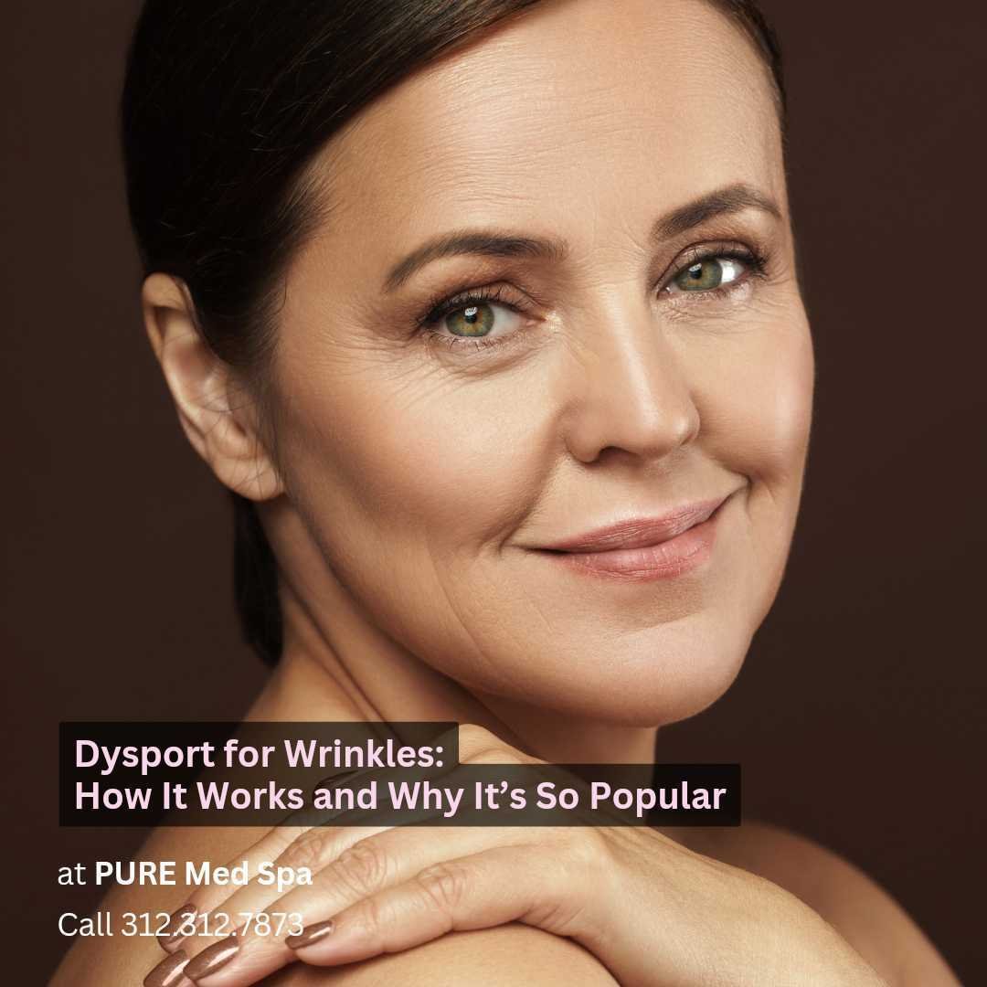 Dysport for Wrinkles Dysport for Wrinkles