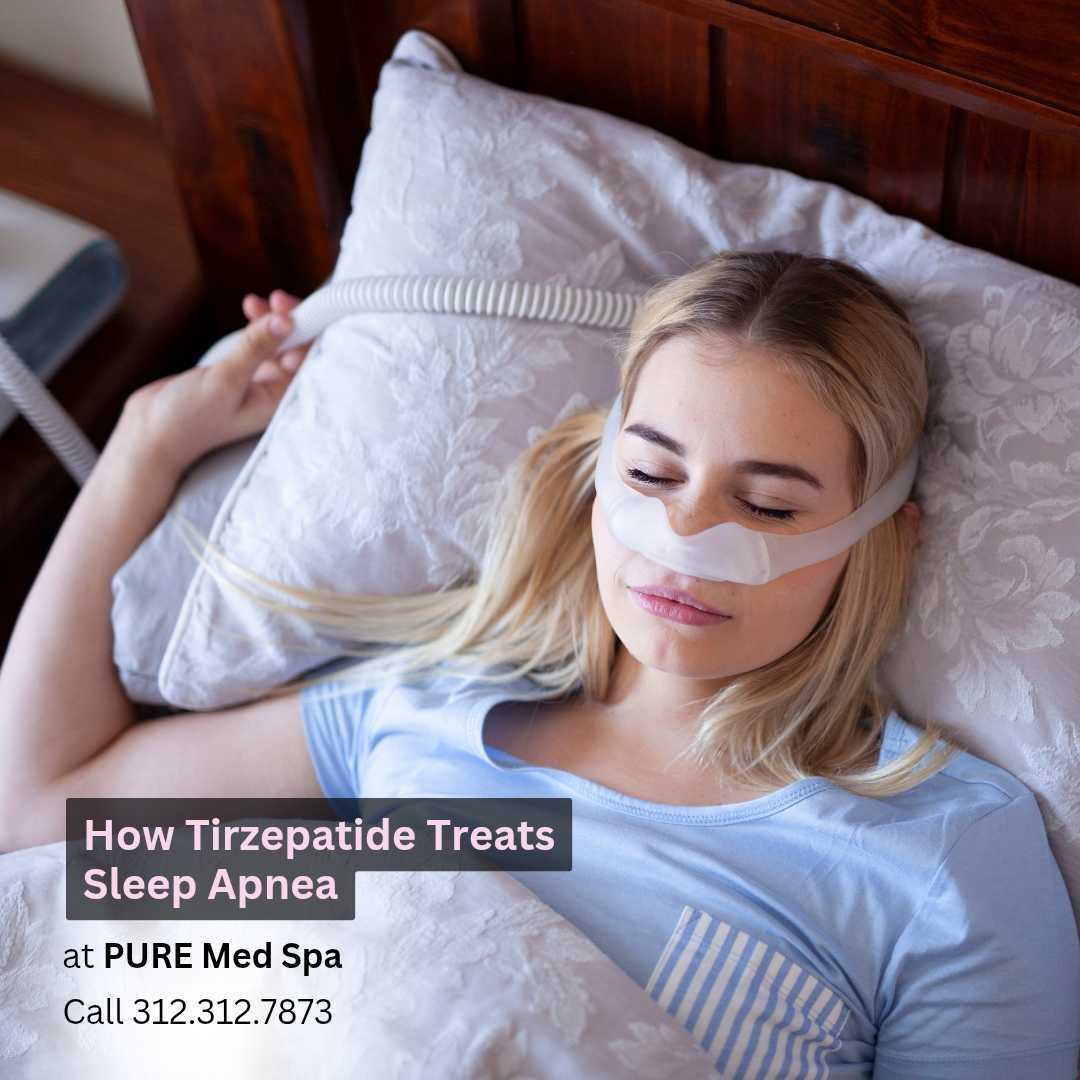 How Tirzepatide Treats Sleep Apnea How Tirzepatide Treats Sleep Apnea