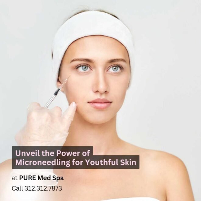 Unveil the Power of Microneedling for Youthful Skin Unveil the Power of Microneedling for Youthful Skin
