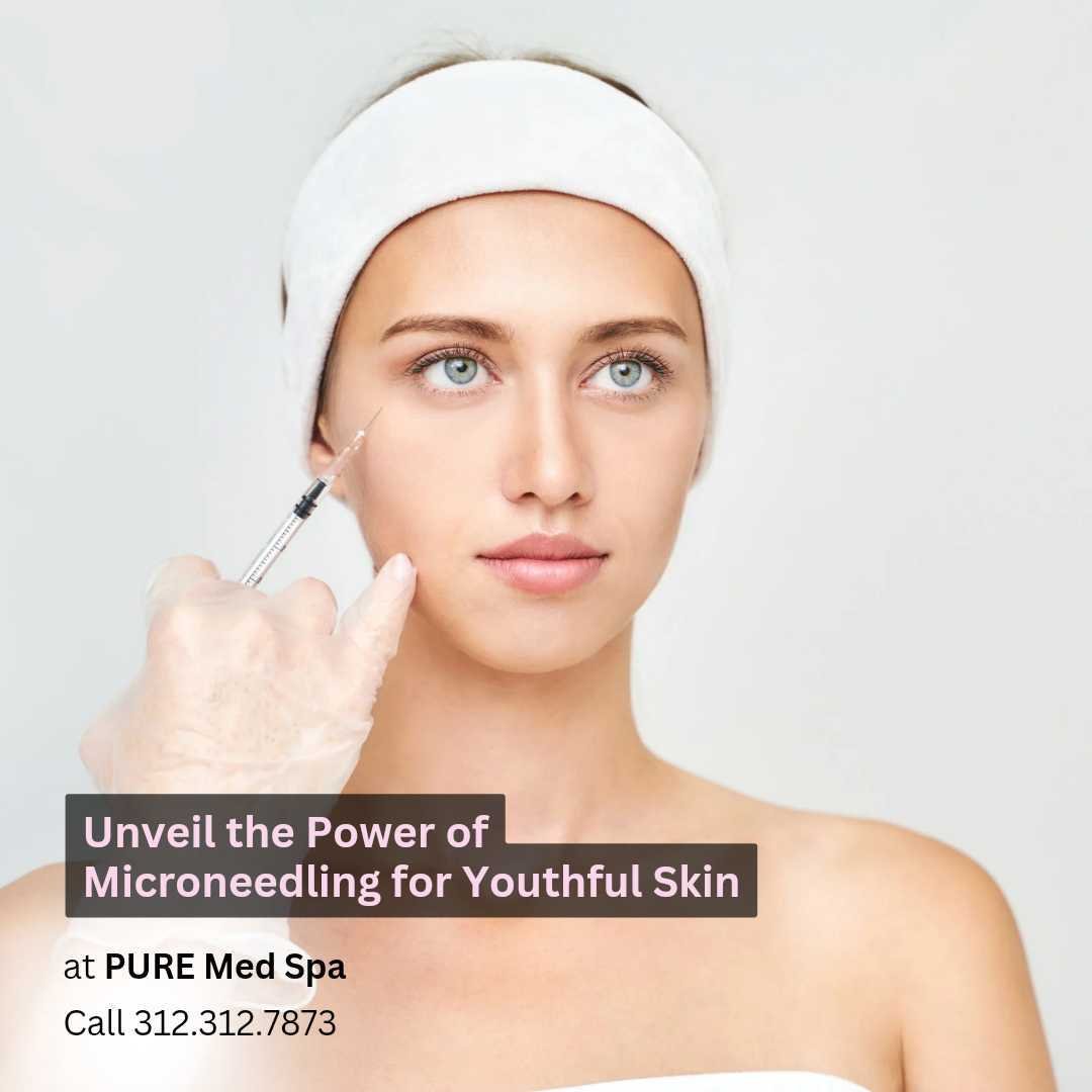 Unveil the Power of Microneedling for Youthful Skin Unveil the Power of Microneedling for Youthful Skin