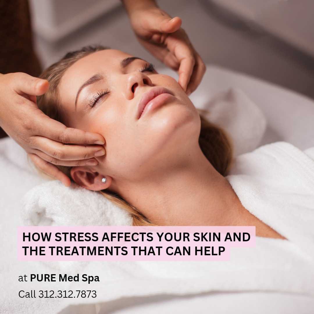 How Stress Affects Your Skin and the Treatments That Can Help How Stress Affects Your Skin and the Treatments That Can Help
