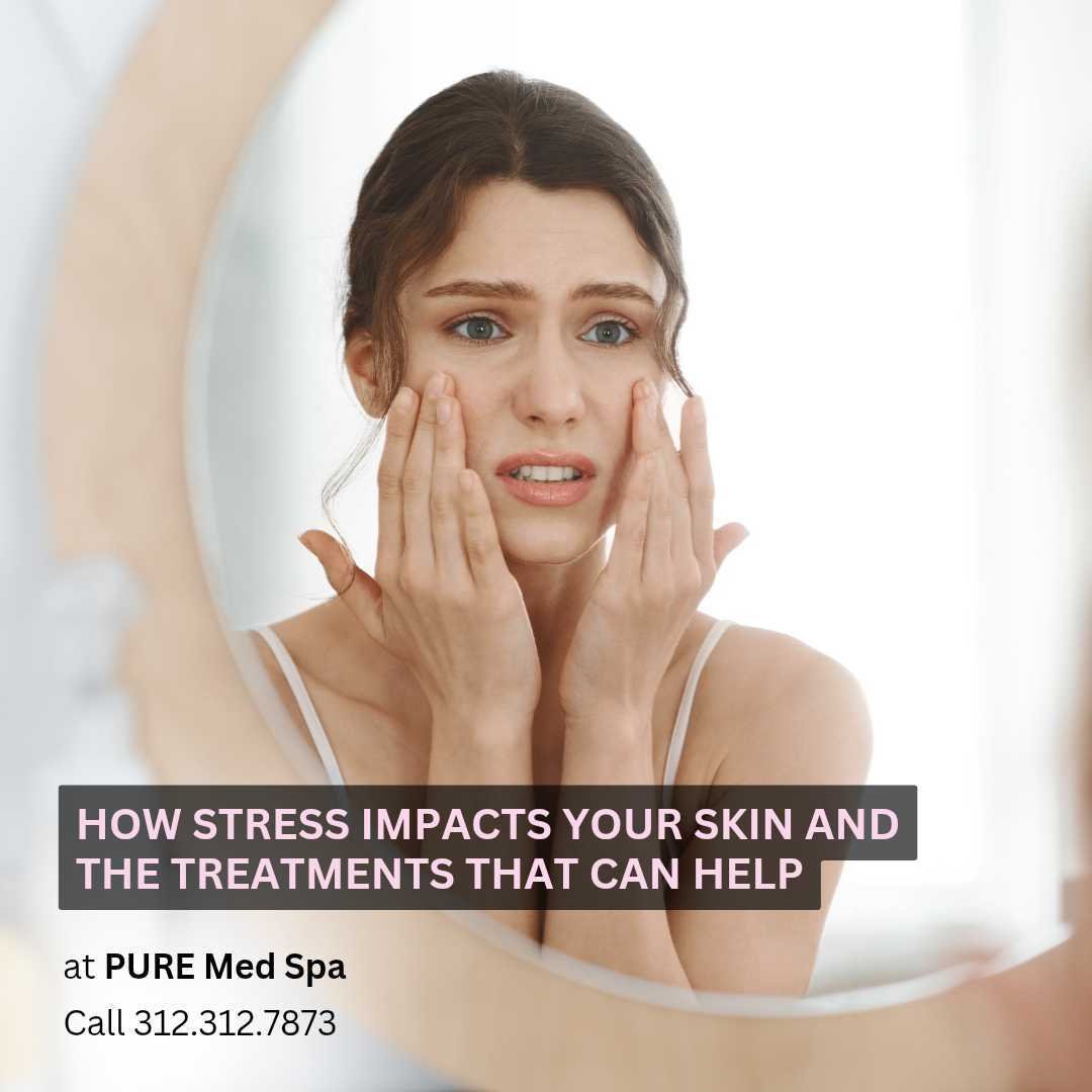 How Stress Impacts Your Skin and the Treatments That Can Help How Stress Impacts Your Skin and the Treatments That Can Help