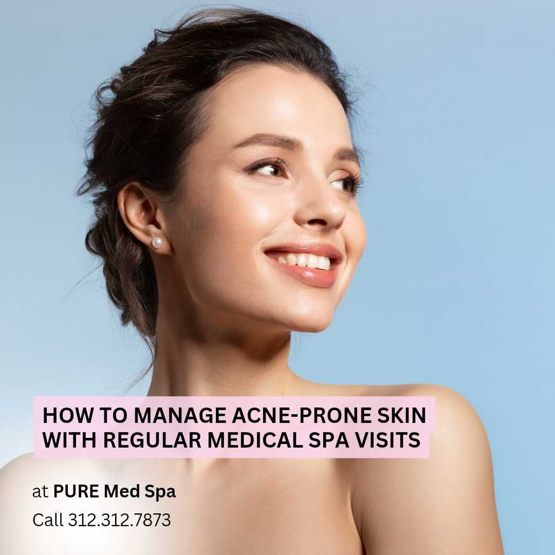 How to Manage Acne-Prone Skin with Regular Medical Spa Visits How to Manage Acne-Prone Skin with Regular Medical Spa Visits
