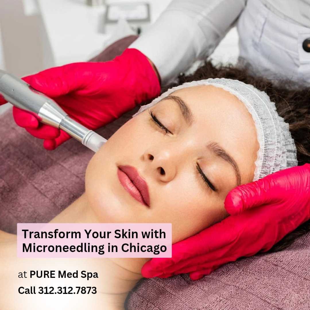Transform Your Skin with Microneedling Chicago Transform Your Skin with Microneedling Chicago