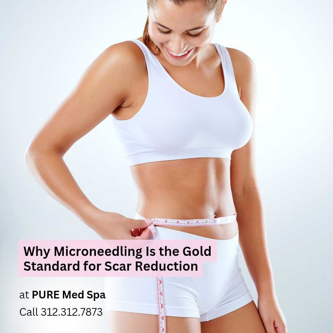 Why Microneedling Is the Gold Standard for Scar Reduction Why Microneedling Is the Gold Standard for Scar Reduction