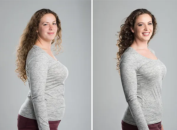 Before and After treatment for weight loss in a 45-year-old female patient at Pure Medical Spa
