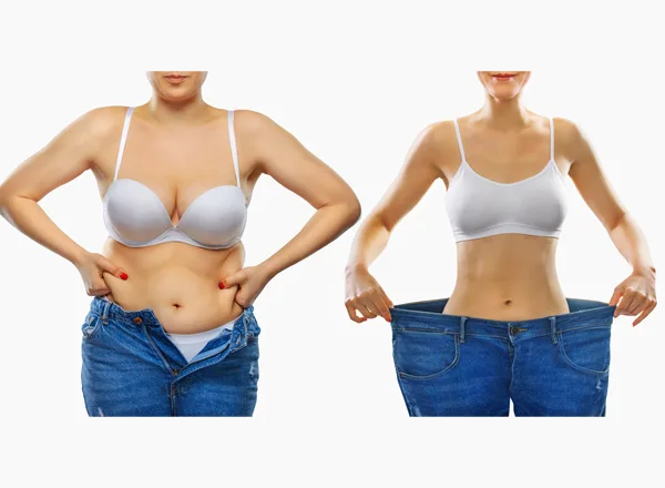 Before and after treatment for weight loss in a 55-year-old female patient at Pure Medical Spa