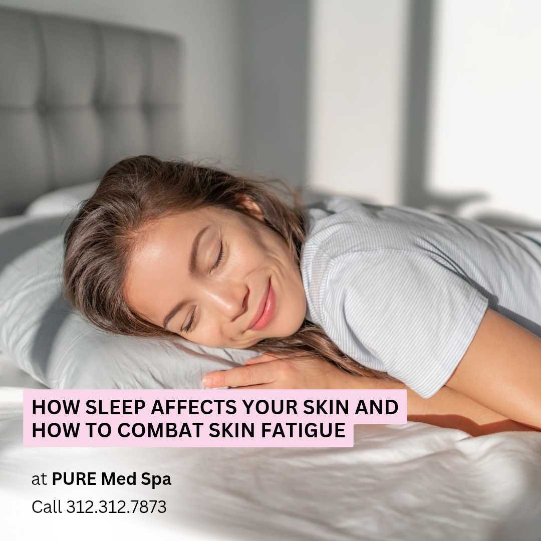 How Sleep Affects Your Skin and How to Combat Skin Fatigue How Sleep Affects Your Skin and How to Combat Skin Fatigue