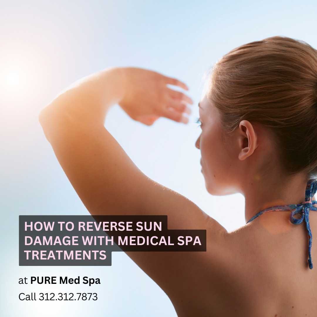 How to Reverse Sun Damage with Medical Spa Treatments How to Reverse Sun Damage with Medical Spa Treatments