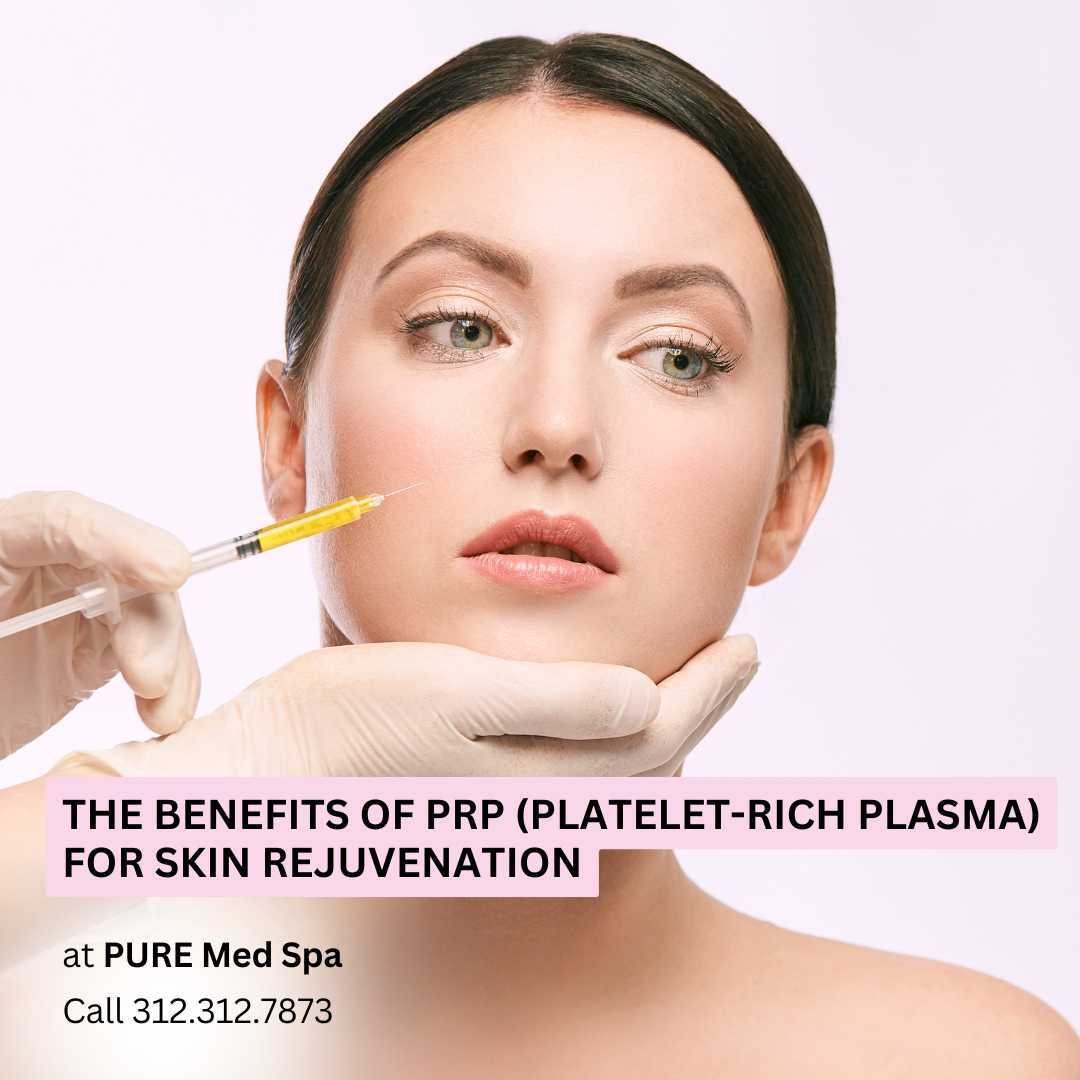 platelet-rich plasma facial platelet-rich plasma facial