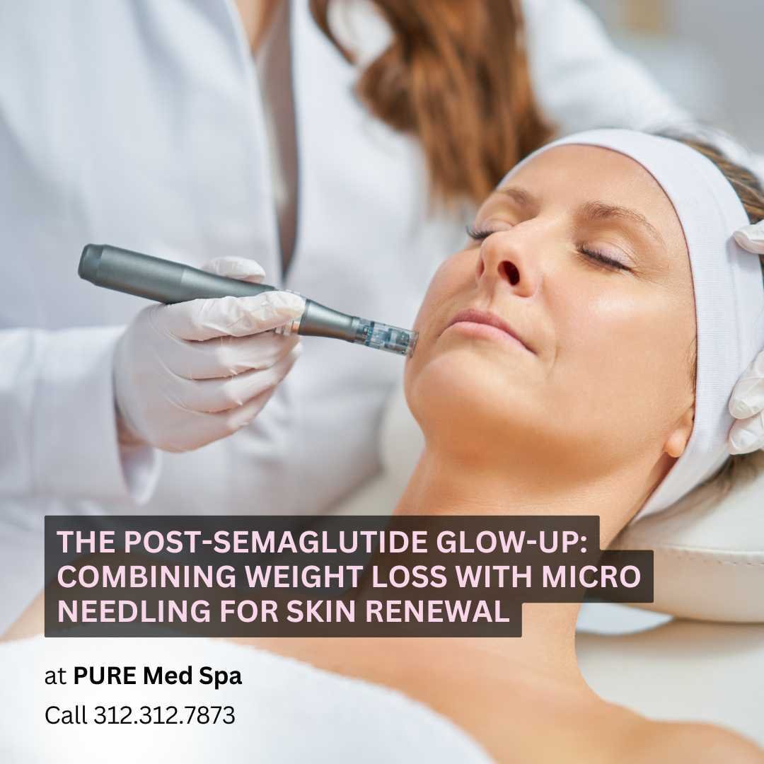 the post Semaglutide glow up The Post-Semaglutide Glow-Up: Combining Weight Loss with Micro needling for Skin Renewal