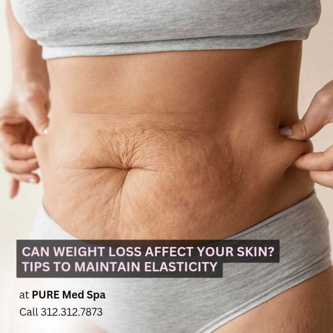 Can Weight Loss Affect Your Skin Tips to Maintain Elasticity Can Weight Loss Affect Your Skin Tips to Maintain Elasticity