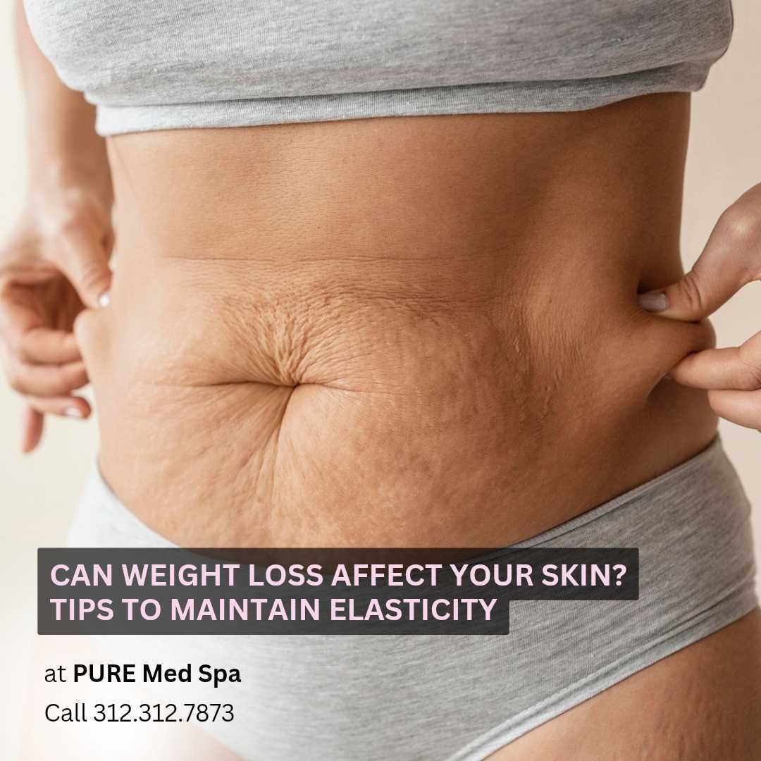 Can Weight Loss Affect Your Skin Tips to Maintain Elasticity Can Weight Loss Affect Your Skin Tips to Maintain Elasticity