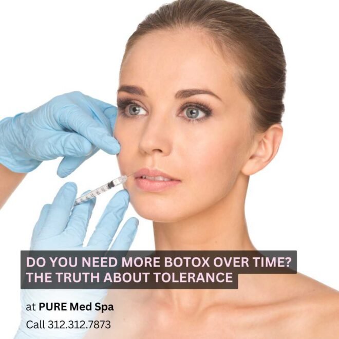 Do You Need More Botox Over Time Do You Need More Botox Over Time