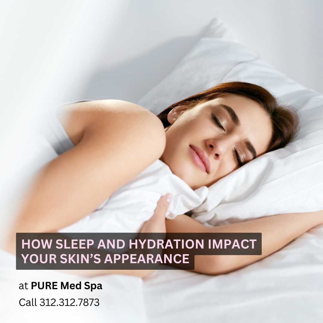 How Sleep and Hydration Impact Your Skin Appearance How Sleep and Hydration Impact Your Skin’s Appearance