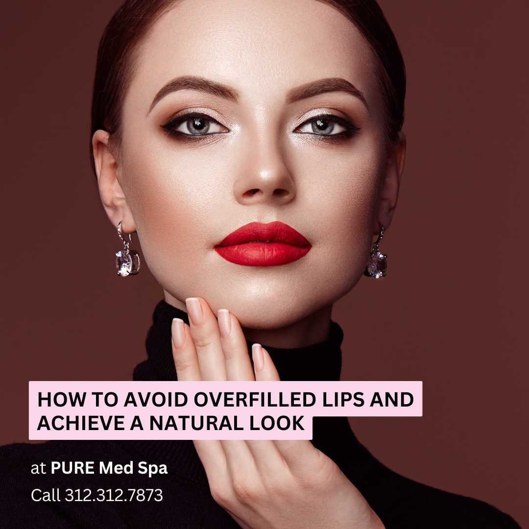 How to Avoid Overfilled lips How to Avoid Overfilled lips