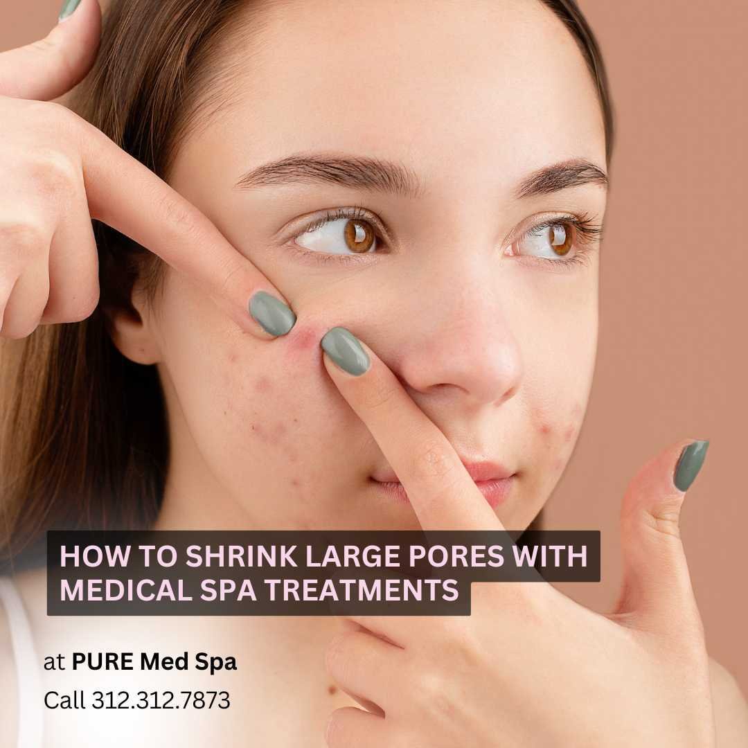 How to Shrink Large Pores How to Shrink Large Pores