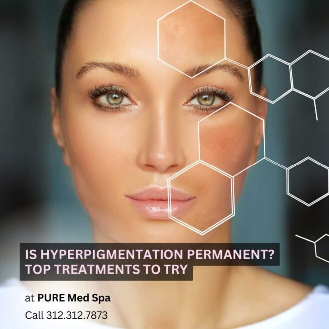 Is Hyperpigmentation Permanent? Best Treatments to Try