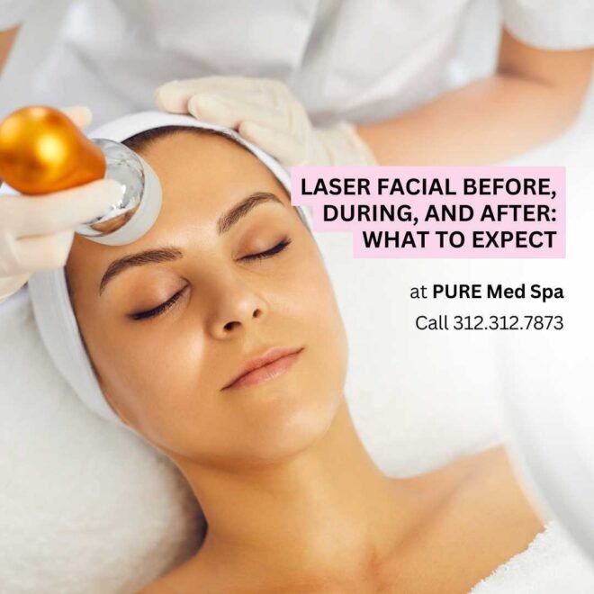 Laser Facial Guide: What to Expect Before, During & After Treatment