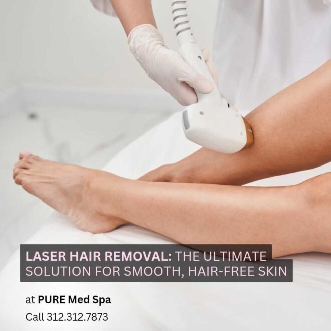 Laser Hair Removal
