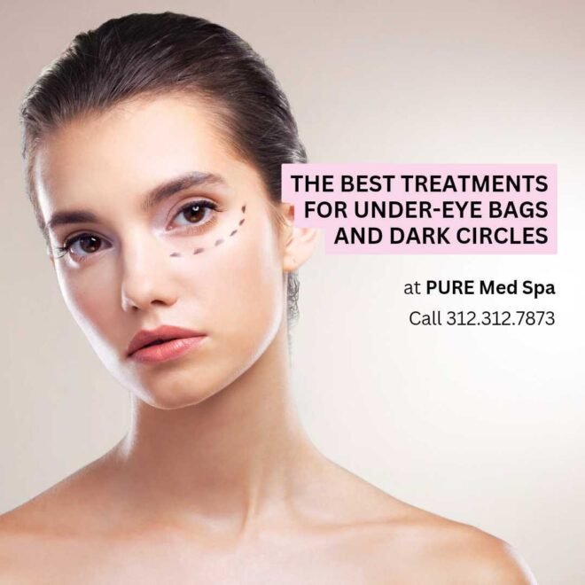 The Best Treatments for Under-Eye Bags and Dark Circles The Best Treatments for Under-Eye Bags and Dark Circles