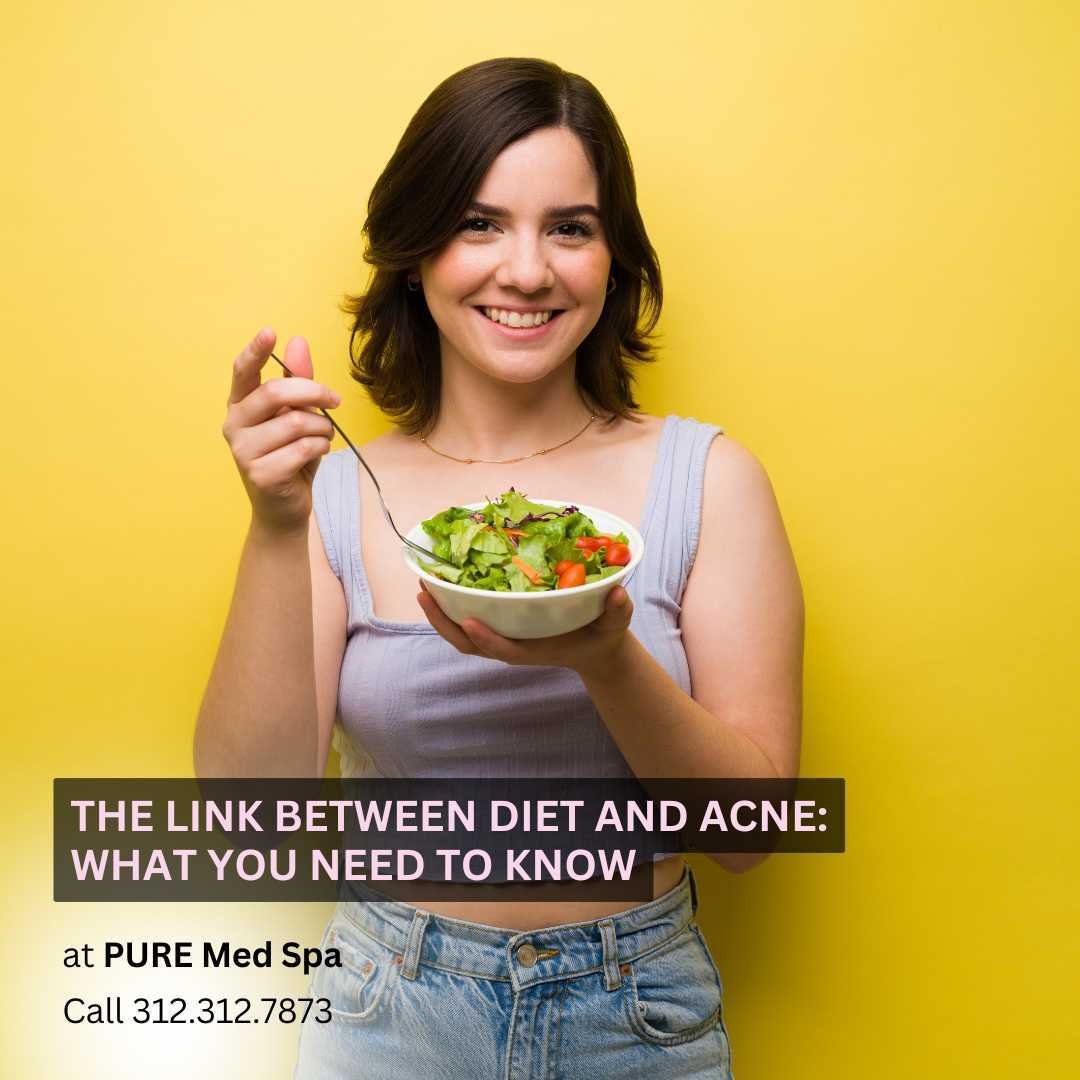 The Link Between Diet and Acne What You Need to Know The Link Between Diet and Acne What You Need to Know