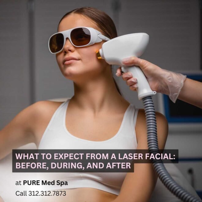 What to Expect from a Laser Facial What to Expect from a Laser Facial