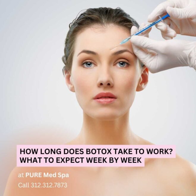 how long does botox take to work