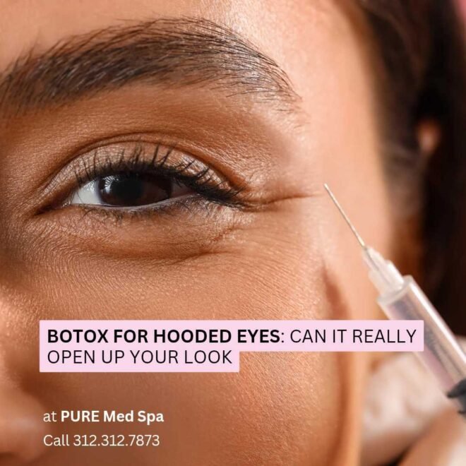 Botox for Hooded Eyes Can It Really Open Up Your Look Botox for Hooded Eyes Can It Really Open Up Your Look