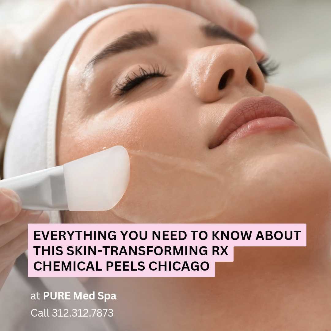 Everything you need to know about this skin transformation rx Everything you need to know about this skin transformation rx