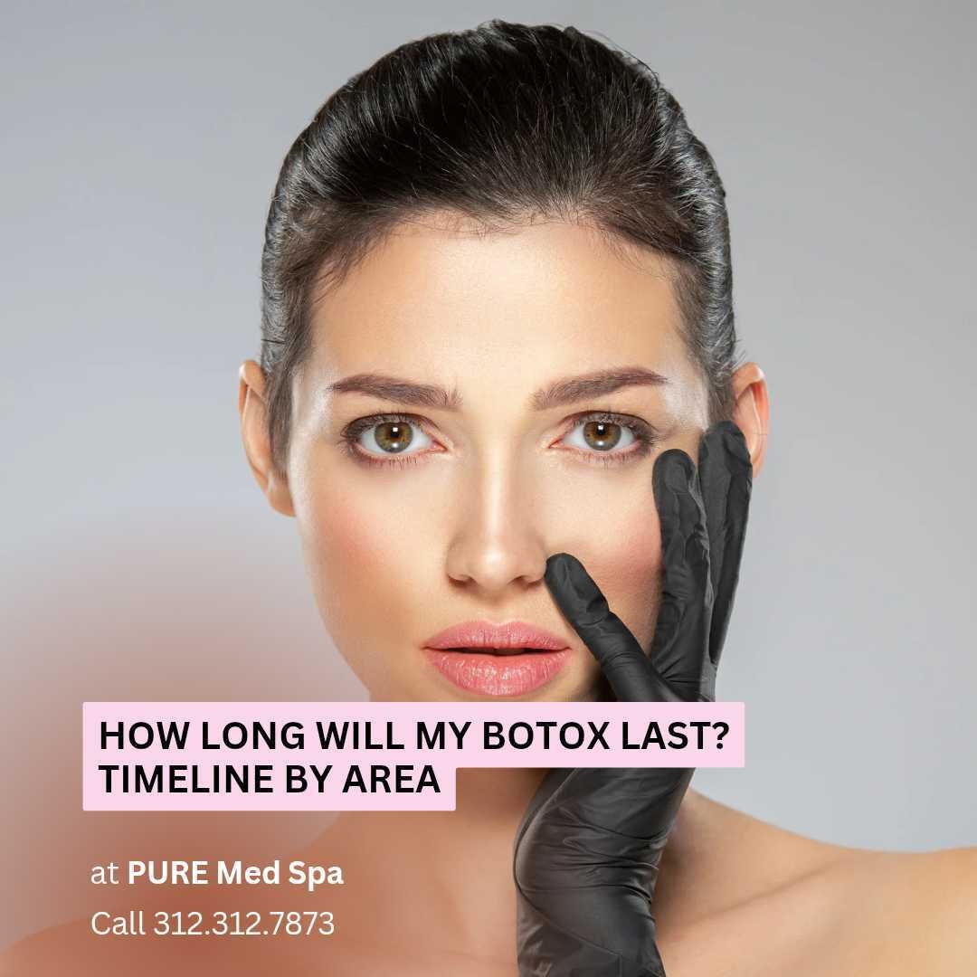 How Long Will My Botox Last How Long Will My Botox Last