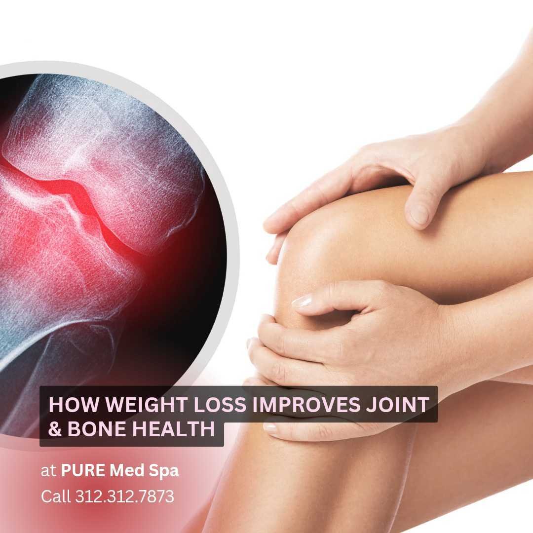 How Weight Loss Improves Joint & Bone Health How Weight Loss Improves Joint & Bone Health