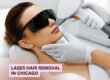 Laser Hair Removal at Pure Medical Spa Chicago