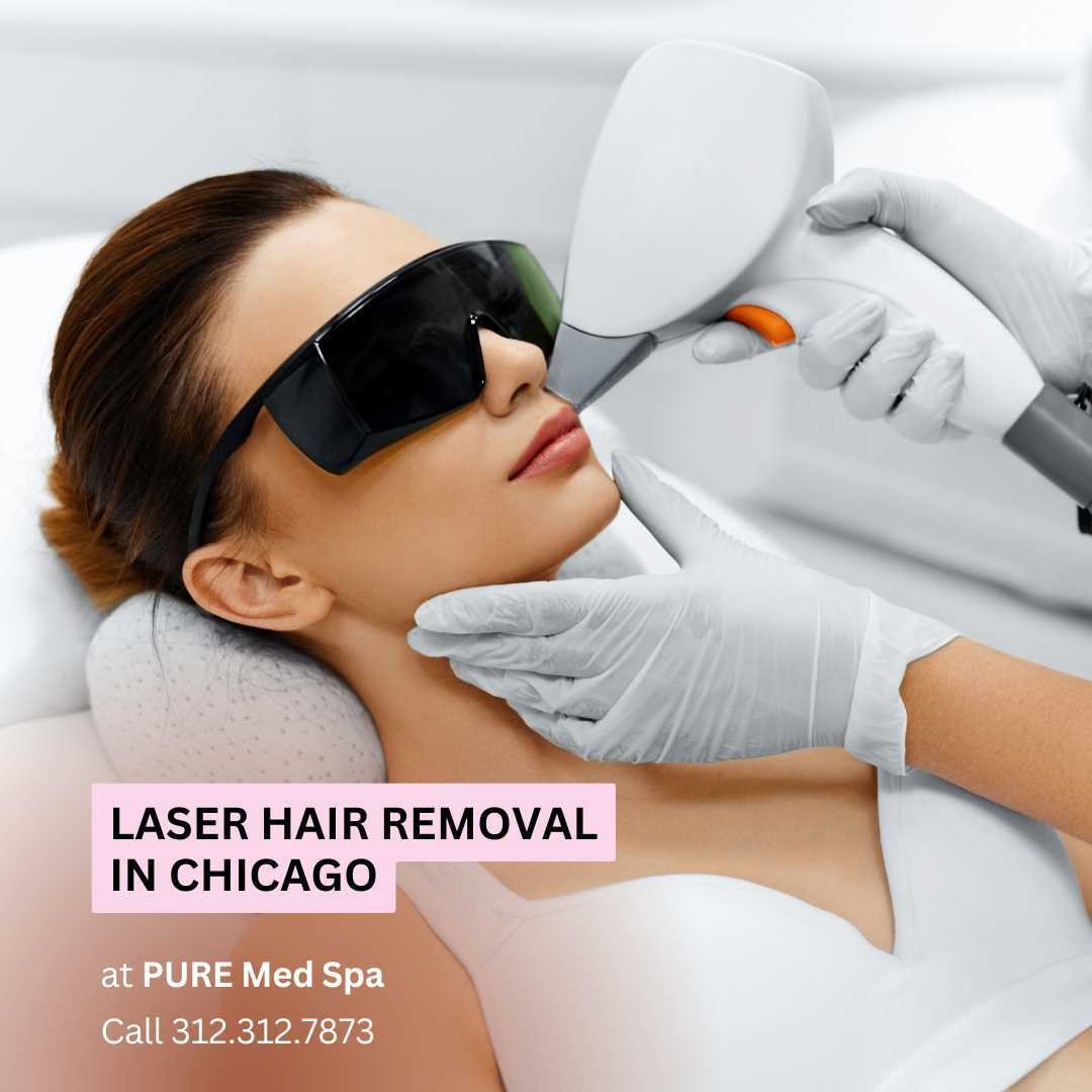 Laser Hair Removal at Pure Medical Spa Chicago Laser Hair Removal at Pure Medical Spa Chicago