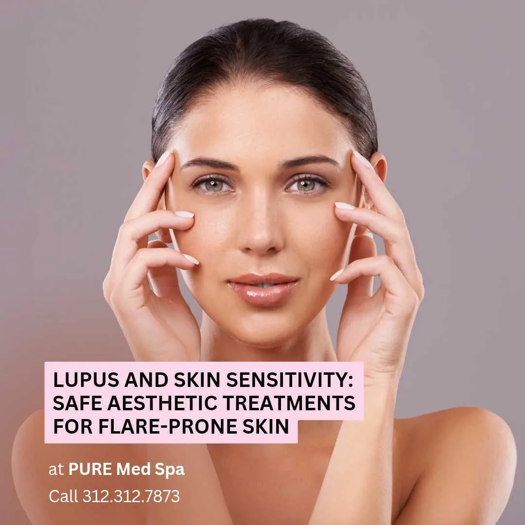 Lupus and Skin Sensitivity Lupus and Skin Sensitivity