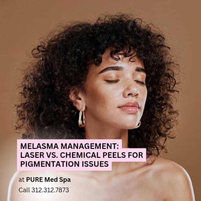 Melasma Management
