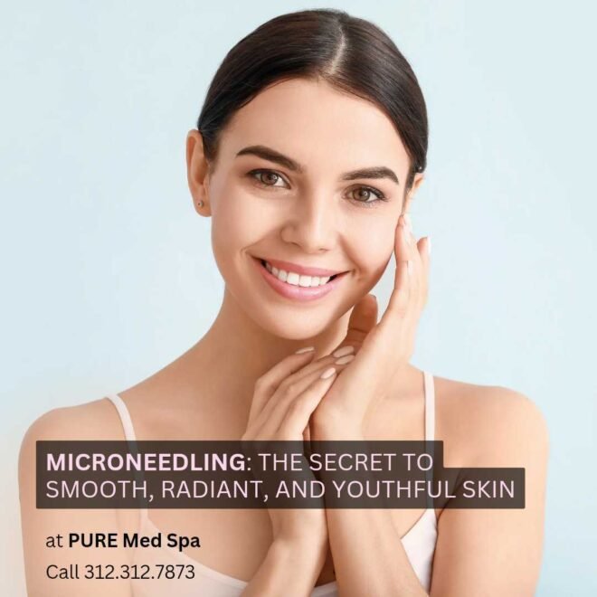 Microneedling The Secret to Smooth, Radiant, and Youthful Skin Microneedling The Secret to Smooth, Radiant, and Youthful Skin