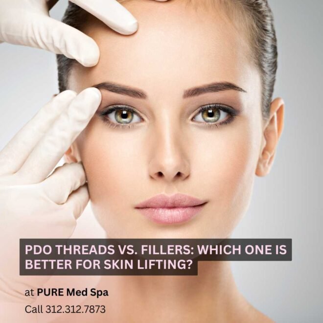 PDO Threads vs. Fillers