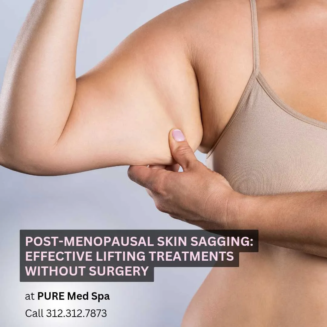 Post-Menopausal Skin Sagging Post-Menopausal Skin Sagging