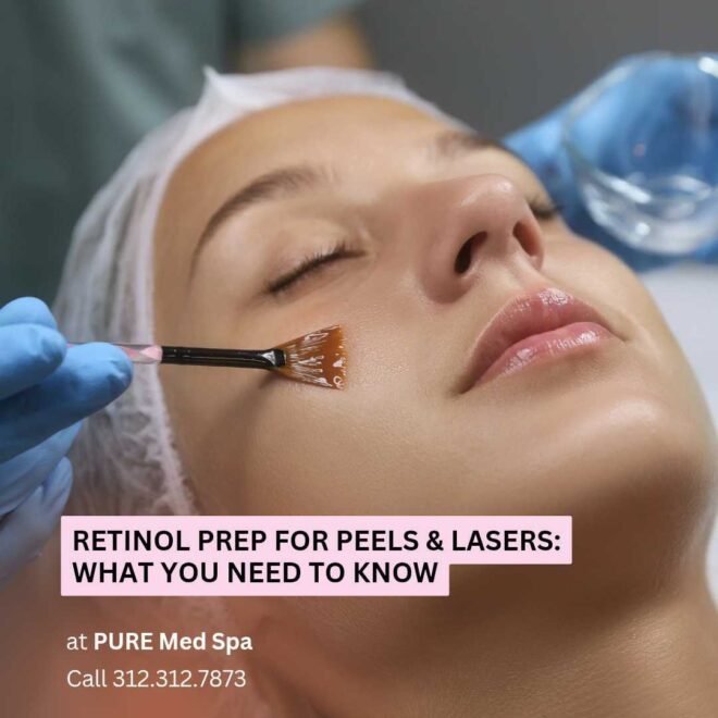 Retinol Prep for Peels & Lasers Retinol Prep for Peels & Lasers