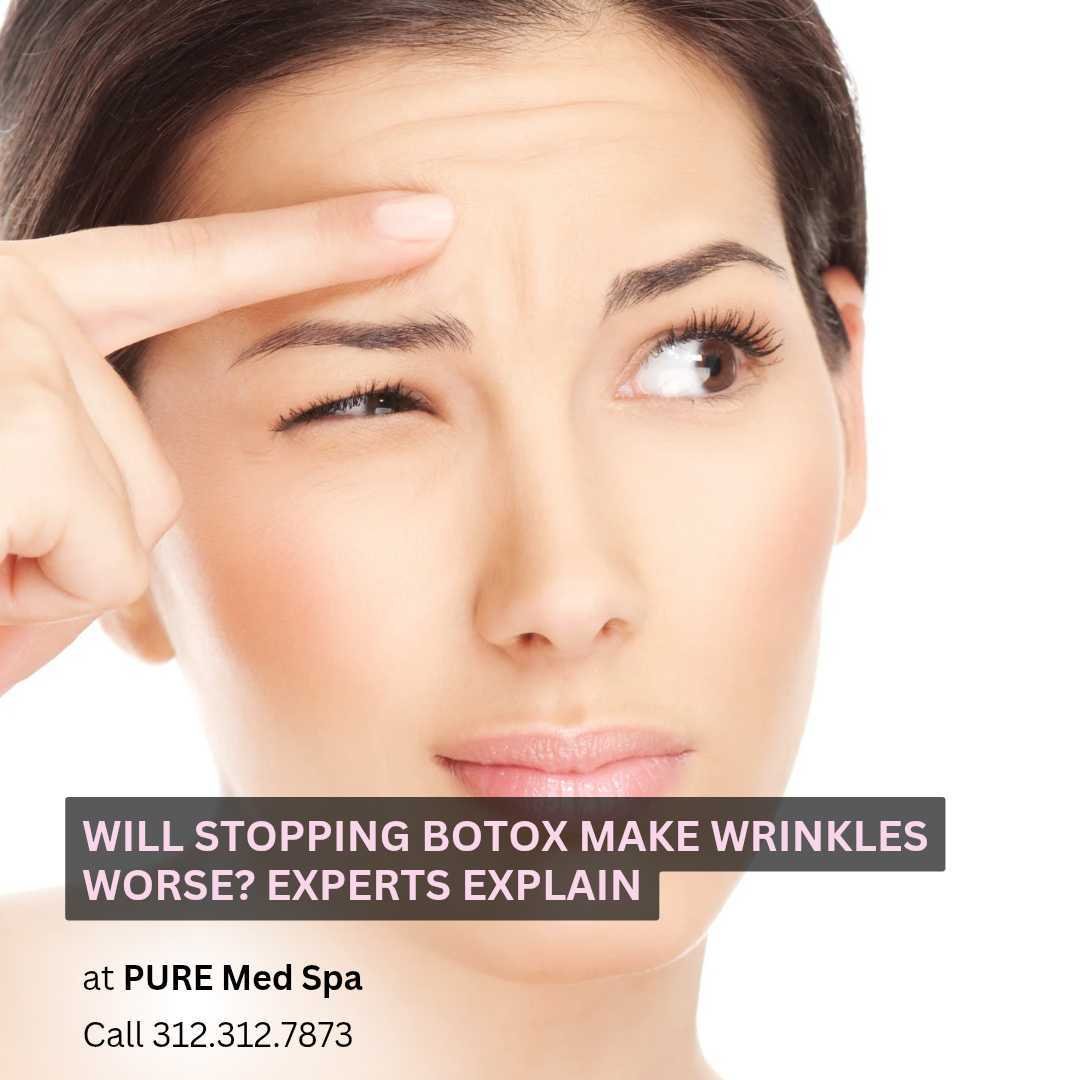 Will Stopping Botox Make Wrinkles Worse Will Stopping Botox Make Wrinkles Worse