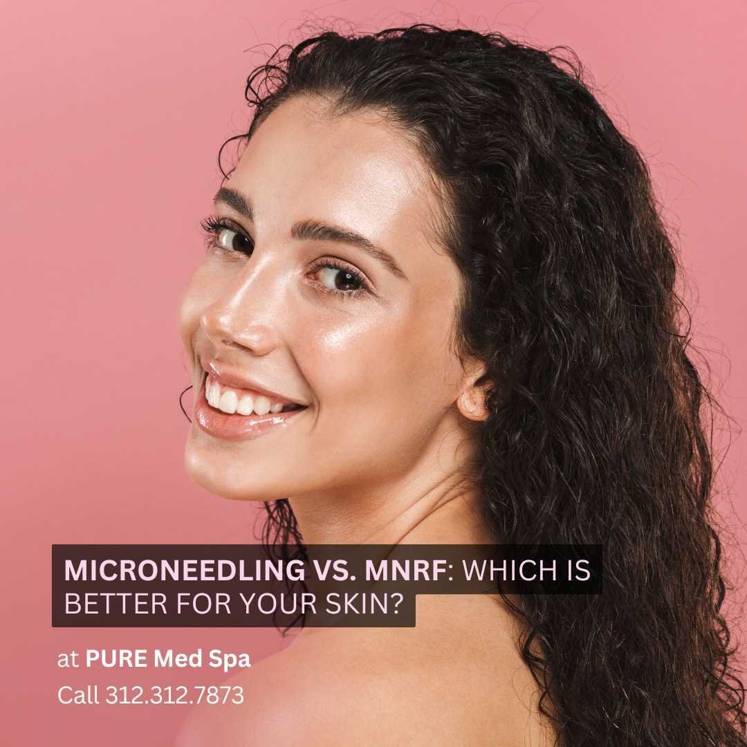 Microneedling vs. MNRF Microneedling vs. MNRF