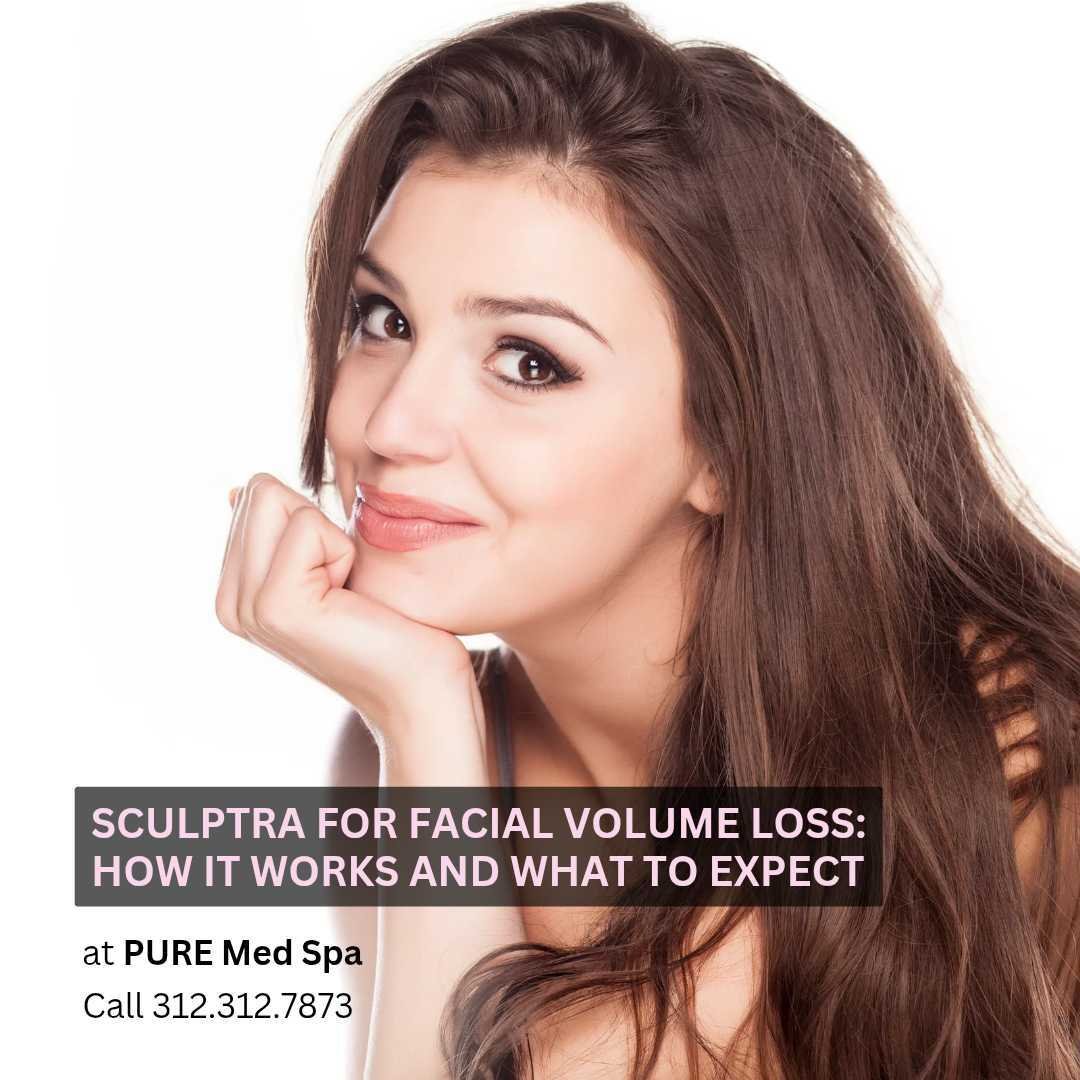 Sculptra for Facial Volume Loss How It Works and What to Expect Sculptra for Facial Volume Loss How It Works and What to Expect