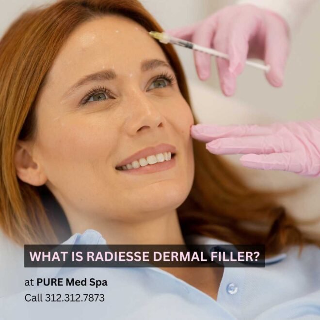 radiesse filler radiesse filler