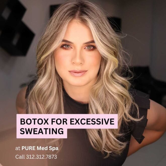 Botox for Excessive Sweating Botox for Excessive Sweating