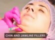 Chin and Jawline Fillers
