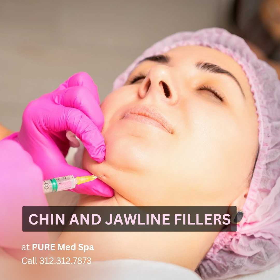 Chin and Jawline Fillers Chin and Jawline Fillers