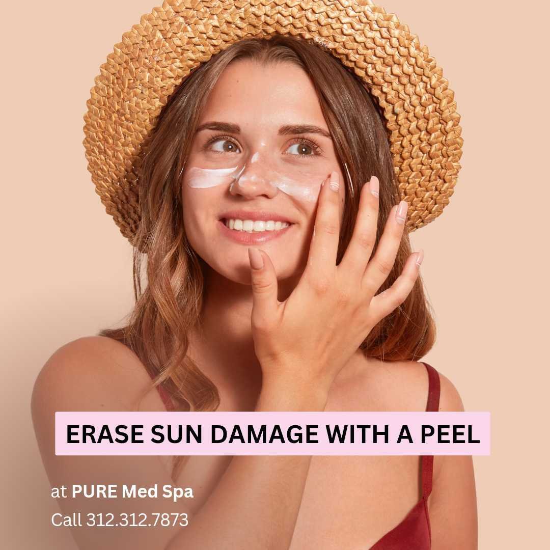 Erase Sun Damage with a Peel Erase Sun Damage with a Peel