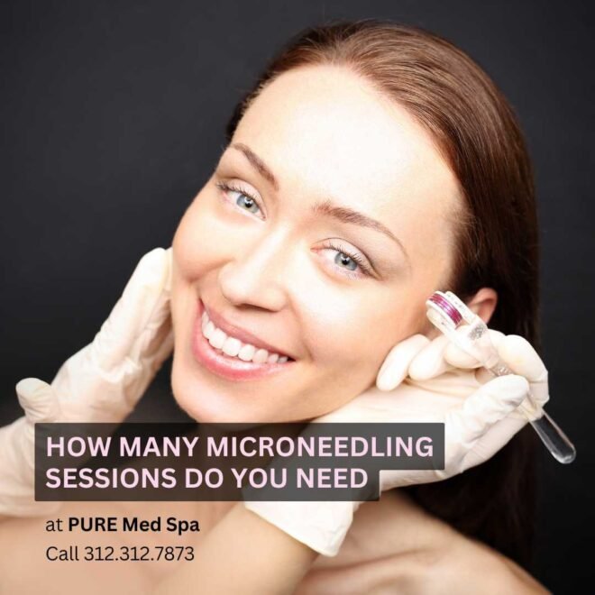 How Many Microneedling Sessions Do You Need