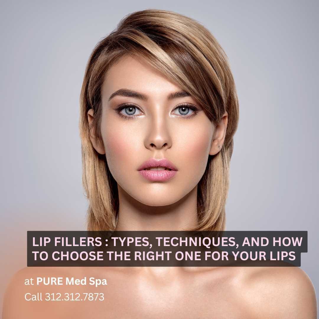 Lip Fillers Lip Fillers